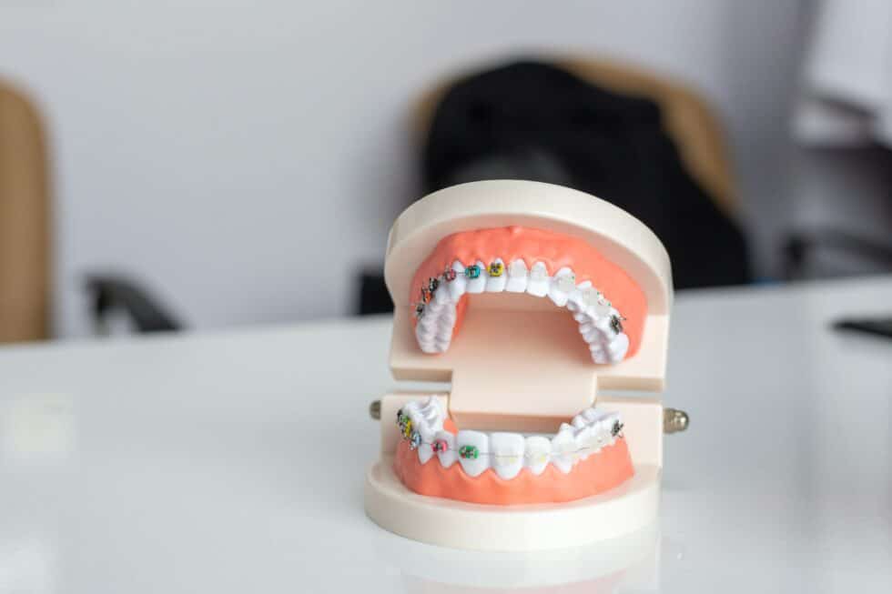 The Pros and Cons of Different Types of Orthodontic Treatment Life